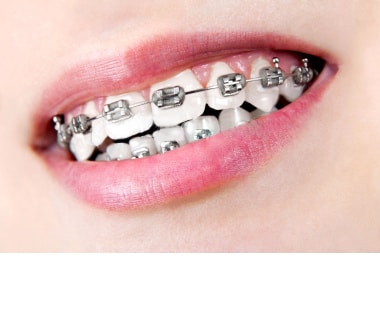 Ortodoncias